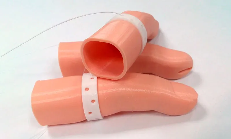 Protesis de dedos impresos en 3D